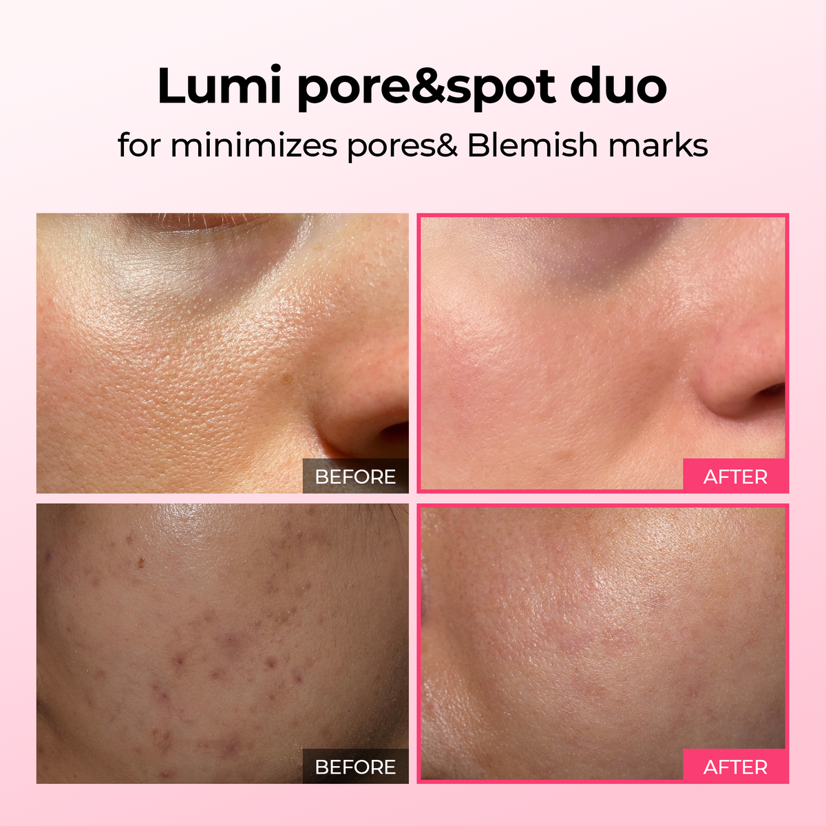 Dr. Melaxin Cemenrete Serum Duo Set 2-Pack Bundle (Cyano Pink Spicule Serum w/ Calcium + Picotonic Shot Calcium Serum) Firming, Pore Tightening, Collagen & Dark Spot Care, 1.01 fl oz Each
