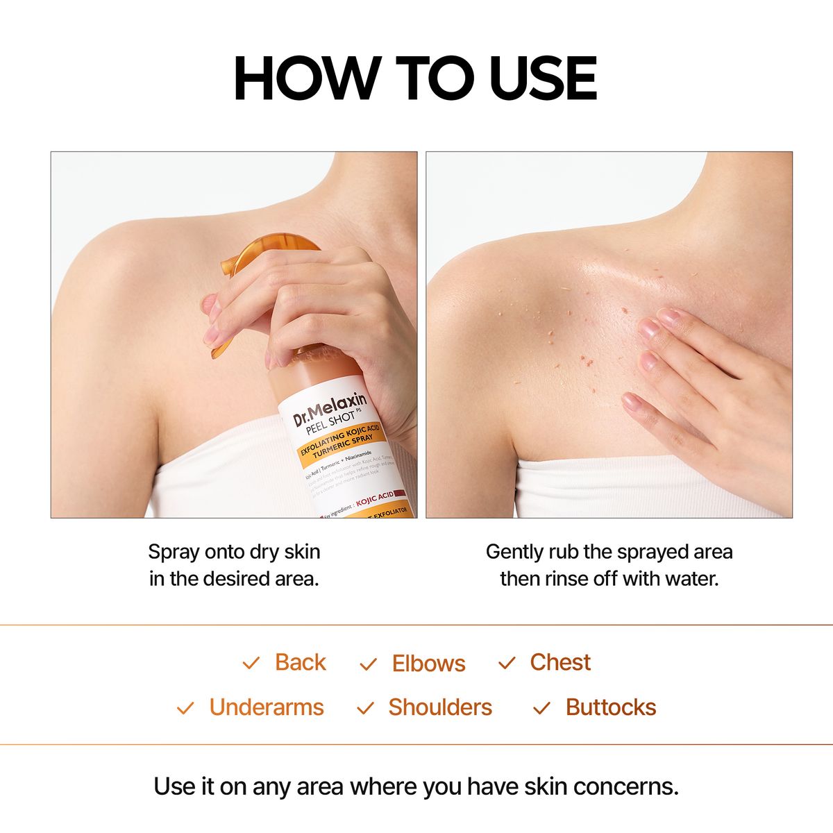 Dr.Melaxin Body Keratin Care Kojic Acid Turmeric Spray Gently Exfoliating Peeling Solution Korean Skincare All Skin Types 200ml